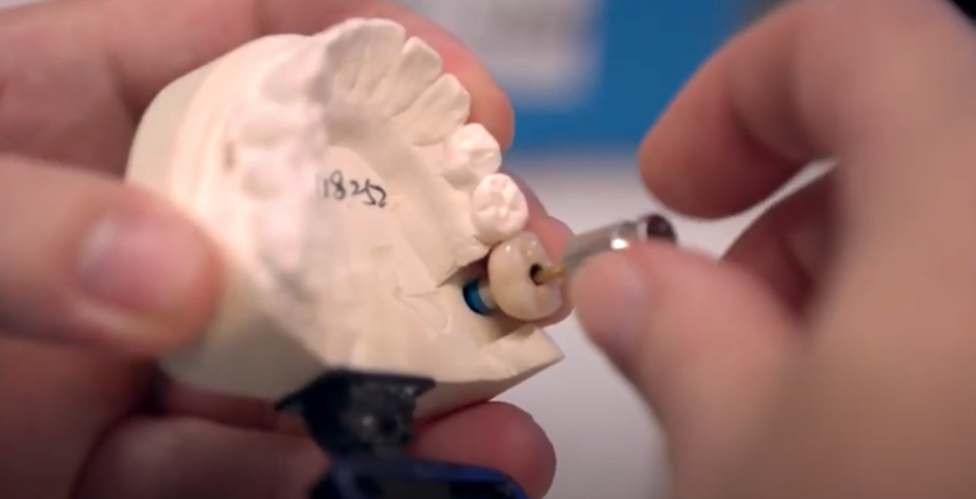 About Us Southern Cross Dental New Zealand