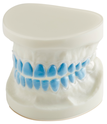 bleaching trays for upper and lower