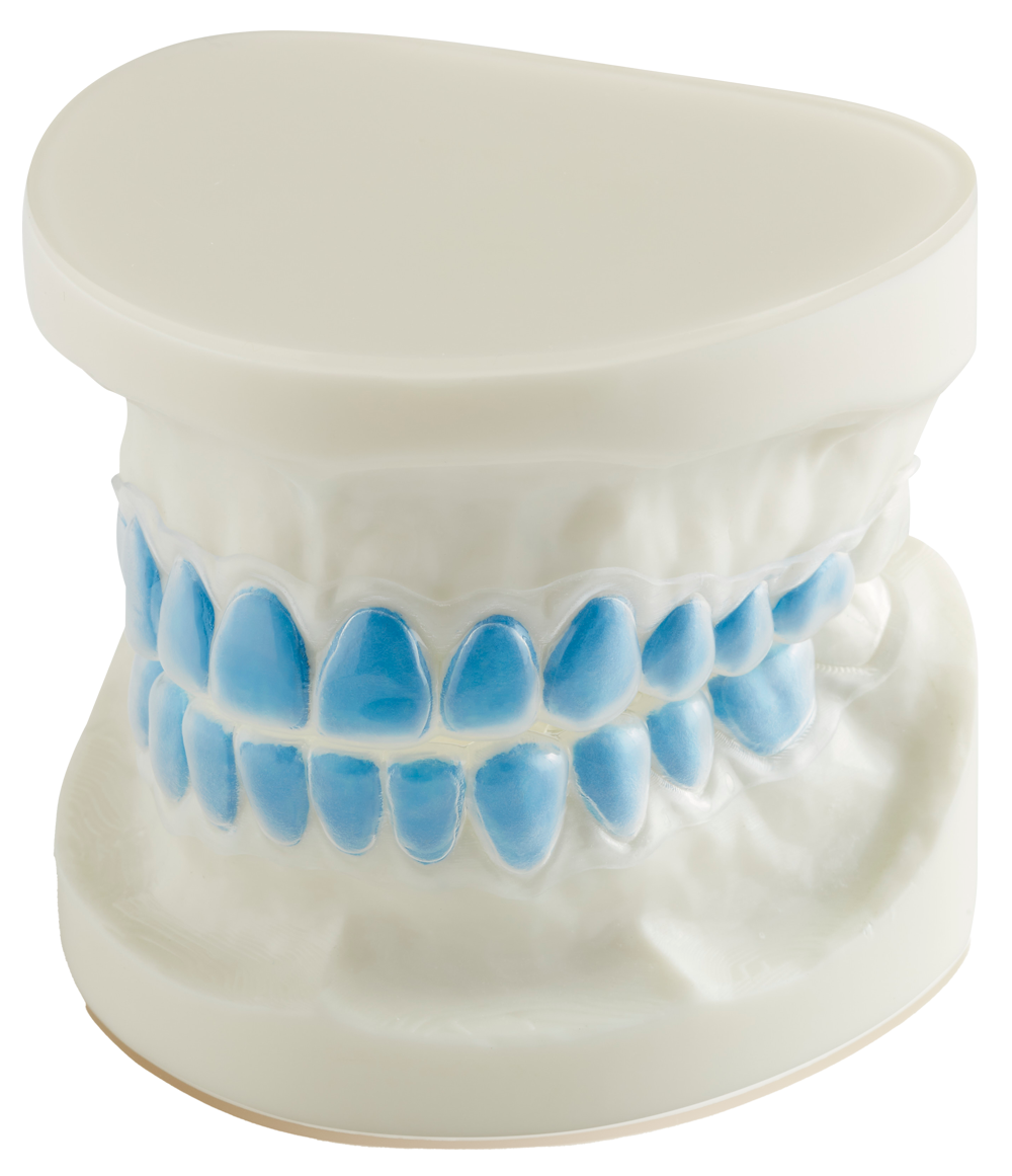 Splints and Appliances Bleaching Trays Teeth Whitening Trays