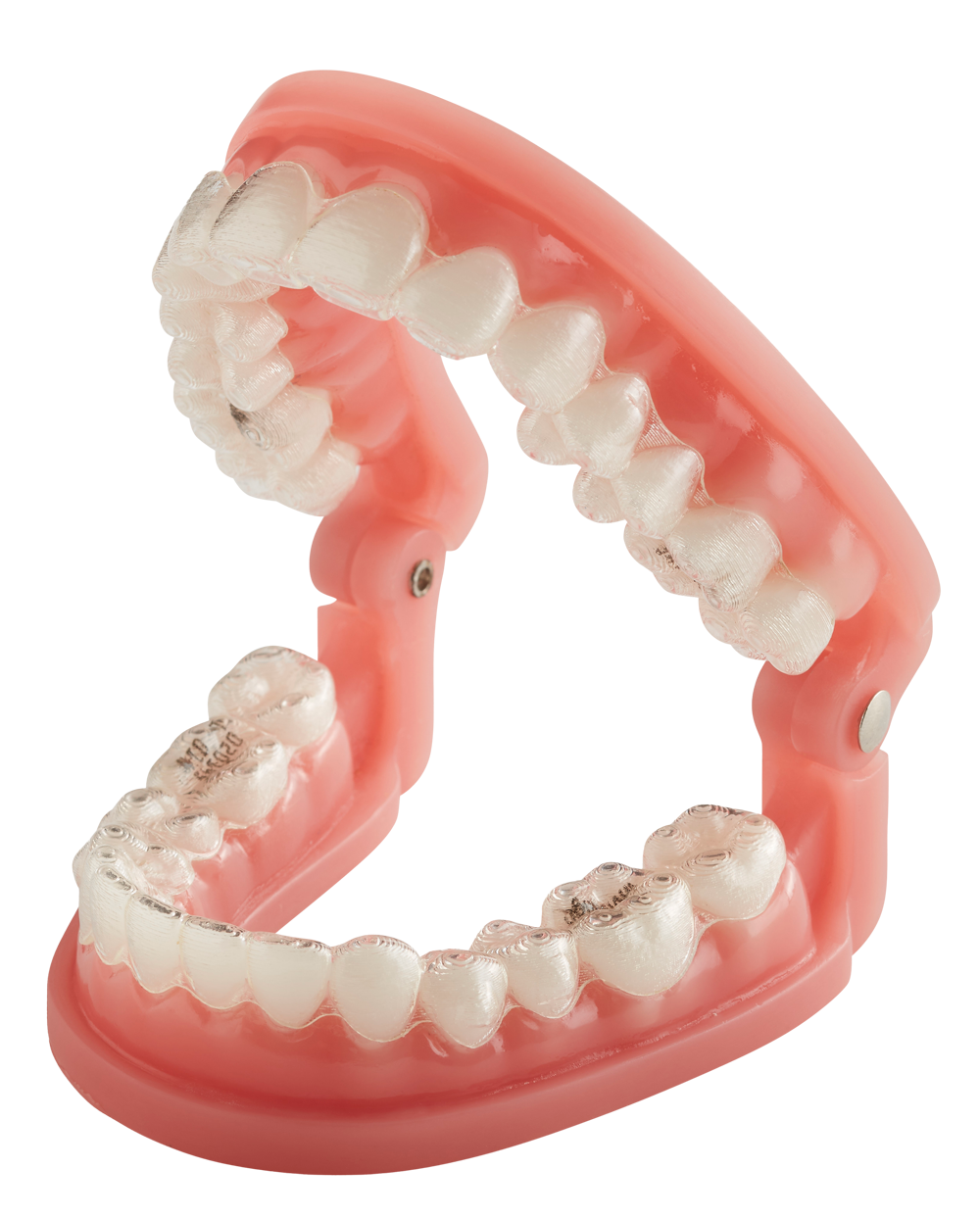 Splints and Appliances, Clear Sequential Aligners