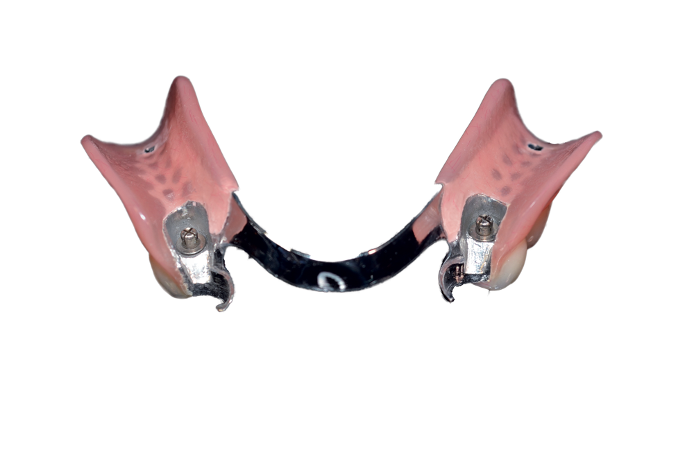 Precision Attachments Southern Cross Dental