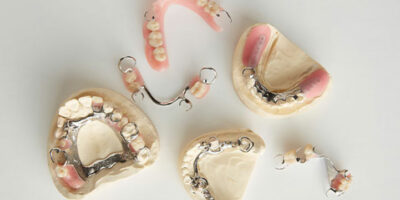 removable partial dentures